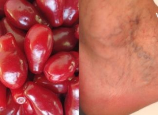 როგორ შეუძლია შინდს გიხსნათ ვარიკოზული ვენების, ფეხების შეშუპების და სხვა დაავადებებისგან? გაიგეთ ამ სტატიაში