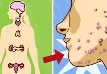 ეს მნიშვნელოვანია – გთავაზობთ იმ საკვების ჩამონათვალს, რომელიც ახდენს ჰორმონალური ბალანსის ნორმალიზებას და აჯანსაღებს კანს