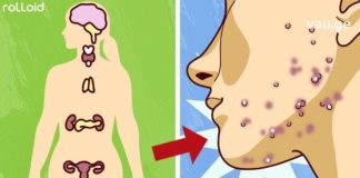 ეს მნიშვნელოვანია – გთავაზობთ იმ საკვების ჩამონათვალს, რომელიც ახდენს ჰორმონალური ბალანსის ნორმალიზებას და აჯანსაღებს კანს