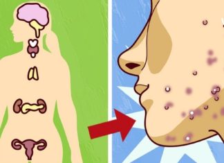 ეს მნიშვნელოვანია – გთავაზობთ იმ საკვების ჩამონათვალს, რომელიც ახდენს ჰორმონალური ბალანსის ნორმალიზებას და აჯანსაღებს კანს