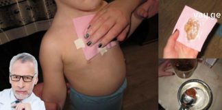 გასაოცარი კომპრესის რეცეპტი, რომელიც პირველივე ცდაზე აჩერებს ხველას