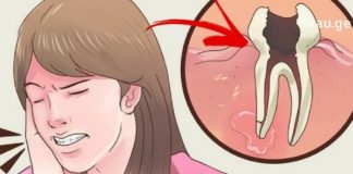 კბილის ტკივილის დროს მოამზადეთ ეს შესანიშნავი მცენარეული წამლები და ტკივილი სამუდამოდ გაქრება.