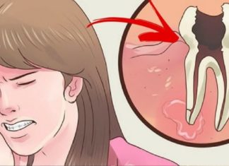 კბილის ტკივილის დროს მოამზადეთ ეს შესანიშნავი მცენარეული წამლები და ტკივილი სამუდამოდ გაქრება.