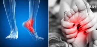 გაწუხებთ ფეხებში წვის შეგრძნება? გასწავლით ეფექტურ მეთოდს ამ პრობლემისგან თავის დასაღწევად