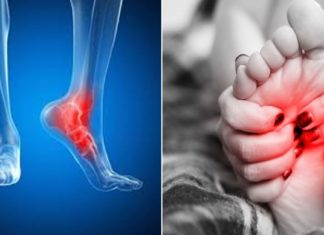 გაწუხებთ ფეხებში წვის შეგრძნება? გასწავლით ეფექტურ მეთოდს ამ პრობლემისგან თავის დასაღწევად