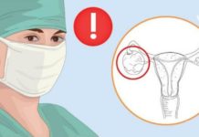 გათხოვების შემდეგ საკვერცხეების პრობლემები დამეწყო, ბევრი მკურნალობის შემდეგ მივადეგი ხალხურ რეცეპტებს და თავს უკვე მშვენივრად ვგრძნობ