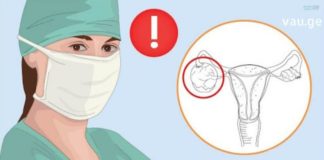 გათხოვების შემდეგ საკვერცხეების პრობლემები დამეწყო, ბევრი მკურნალობის შემდეგ მივადეგი ხალხურ რეცეპტებს და თავს უკვე მშვენივრად ვგრძნობ