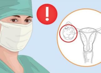 გათხოვების შემდეგ საკვერცხეების პრობლემები დამეწყო, ბევრი მკურნალობის შემდეგ მივადეგი ხალხურ რეცეპტებს და თავს უკვე მშვენივრად ვგრძნობ