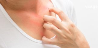 მუნის მკურნალობის გასამარტივებლად ეს გამორჩეული მეთოდები სცადეთ