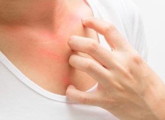 მუნის მკურნალობის გასამარტივებლად ეს გამორჩეული მეთოდები სცადეთ