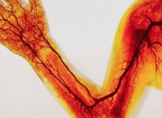 რა უნდა მოვიმოქმედოთ როცა ხელის არტერიების შევიწროვება გვაქვს?!