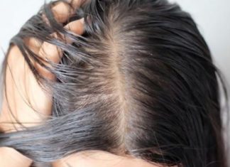 თუ ცხმიანი თმა გაქვთ, გაგიზიარებთ შესანშნავ რეცეპტებს, რომლებიც უმოკლეს დროში დაგეხმარებათ