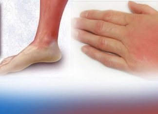 დაამარცხეთ წითელი ქარის დაავადება ამ მცენარეული რეცეპტებით!