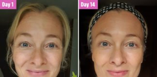 ჭინჭრის ბალზამის სასწაულმოქმედი ეფექტი გასაახალგაზრდავებლად.