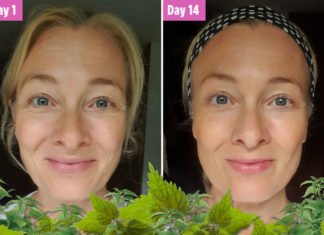 ჭინჭრის ბალზამის სასწაულმოქმედი ეფექტი გასაახალგაზრდავებლად.