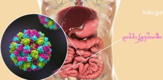 დისბაქტერიოზის მკურნალობის ყველაზე ეფექტური რეცეპტი