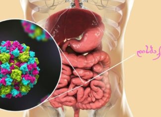 დისბაქტერიოზის მკურნალობის ყველაზე ეფექტური რეცეპტი