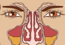 რა უნდა მოიმოქმედოთ იმისათვის რომ ჰაიმორიტმა არ შეგაწუხოთ?!