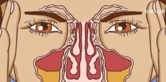 რა უნდა მოიმოქმედოთ იმისათვის რომ ჰაიმორიტმა არ შეგაწუხოთ?!