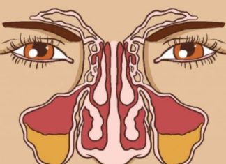 რა უნდა მოიმოქმედოთ იმისათვის რომ ჰაიმორიტმა არ შეგაწუხოთ?!