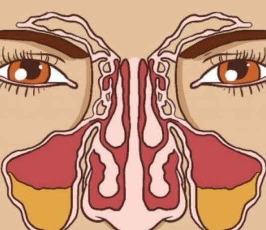 რა უნდა მოიმოქმედოთ იმისათვის რომ ჰაიმორიტმა არ შეგაწუხოთ?!