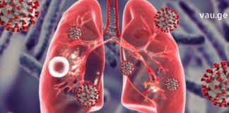 როგორ დავამარცხოთ ფილტვების ტუბერკულოზი?