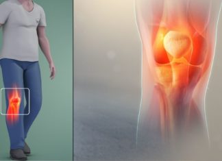 მუხლების ტკივილი გტანჯავთ? გაგიზიარებთ მრავალჯერ წარმატებით ნაცად რეცეპტს