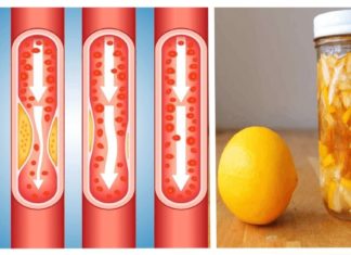 ლიმონით დამზადებული რეცეპტები ჯანსაღი სისხლძარღვებისთვის – გთავაზობთ 3 ვარიანტს!