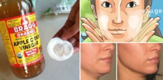 ვაშლის ძმრის დადებითი ეფექტი კანზე