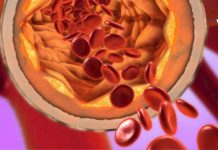 უკვე წლებია ამ საშუალებით ვიმაგრებ სისხლძარღვებს