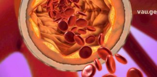 უკვე წლებია ამ საშუალებით ვიმაგრებ სისხლძარღვებს