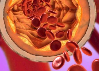 უკვე წლებია ამ საშუალებით ვიმაგრებ სისხლძარღვებს