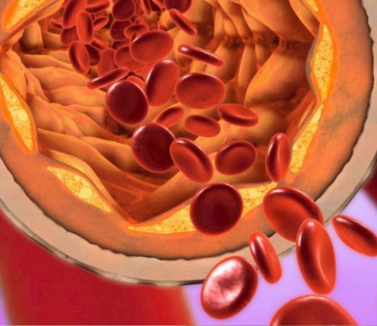 უკვე წლებია ამ საშუალებით ვიმაგრებ სისხლძარღვებს