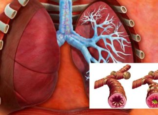 როგორ ვმართოთ ბრონქული ასთმა სახლის პირობებში?