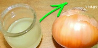 საშარდე გზებში კენჭების დაშლის უებარი საშუალება