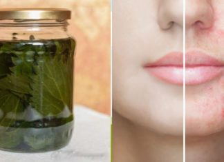 თუ გარდატეხის ასაკის გამონაყარი გტანჯავთ, გაგიზიარებთ შოკისმომგვრელ მეთოდს