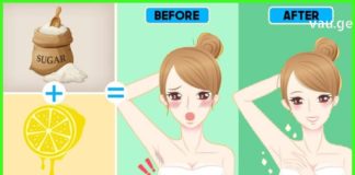 Როგორ მოვიშოროთ იღლიიდან თმა საპარსის და ეპილატორის გარეშე . დაივიწყეთ ჭრილობები და ტკივილი!