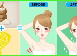 Როგორ მოვიშოროთ იღლიიდან თმა საპარსის და ეპილატორის გარეშე . დაივიწყეთ ჭრილობები და ტკივილი!