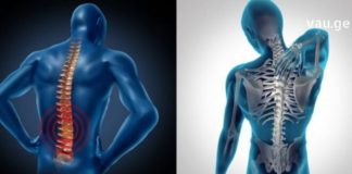 ხერხემლის ოსტეოქონდროზს ამ წამლით უმკურნალებთ