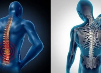 ხერხემლის ოსტეოქონდროზს ამ წამლით უმკურნალებთ