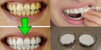 ქოქოსის ზეთი: ბევრად ეფექტური და ჯანსაღი ვიდრე ნებიამიერი კბილის პასტა