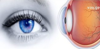 ამ მარტივი გზებით გაუფრთხილდით მხედველობას