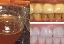 თუ გსურთ კარგი ჯანსაღი კბილები, თქვენ უნდა მოამზდოთ ეს ჩაი