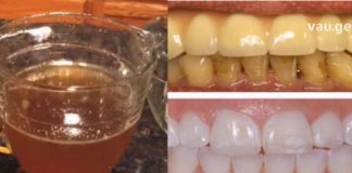 თუ გსურთ კარგი ჯანსაღი კბილები, თქვენ უნდა მოამზდოთ ეს ჩაი