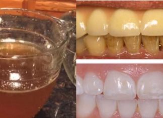 თუ გსურთ კარგი ჯანსაღი კბილები, თქვენ უნდა მოამზდოთ ეს ჩაი