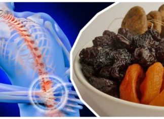 Გაწუხებთ ზურგის და ფეხის ტკივილი? ეს წამალი სამუდამოდ მოგიხსნით აუტანელ ტკივილს!