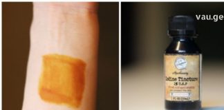 იოდის ეფექტურობა დადასტურებულია : მნიშვნელოვანია ვიციდეთ, ჭრილობების დამუშავების გარდა კიდევ რისთვის გამოიყენება