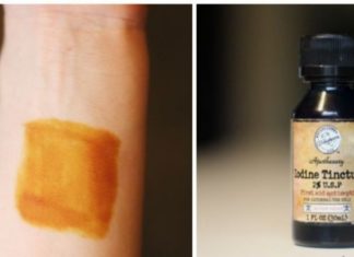 იოდის ეფექტურობა დადასტურებულია : მნიშვნელოვანია ვიციდეთ, ჭრილობების დამუშავების გარდა კიდევ რისთვის გამოიყენება