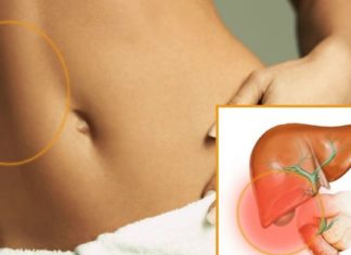 როდის ვითარდება ქოლეცისტიტი და რითი შეგვიძლია გამკლავება – მნიშვნელოვანი ინფორმაცია