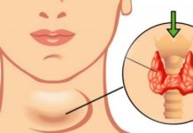 იოდი სასიცოცხლოდ მნიშვნელოვანია ჩვენი ჯანმრელობისთვის. როგორ მოვიქცეთ რომ იოდდეფიციტი ავიცილოთ?